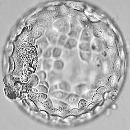 Processen för äggimplantation och embryoöverföring